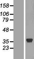 ls003948 lactate dehydrogenase c ldhc human over expression lysates nm 002301 wb testing 1