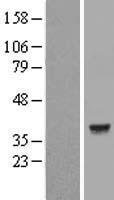 ls003948 lactate dehydrogenase c ldhc human over expression lysates nm 017448 wb testing 2