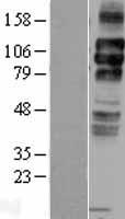 ls003949 ldl receptor ldlr human over expression lysates nm 000527 wb testing 3