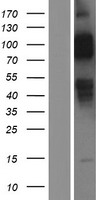 ls003949 ldl receptor ldlr human over expression lysates nm 001195800 wb testing 1