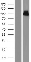 ls003949 ldl receptor ldlr human over expression lysates nm 001195803 wb testing 2