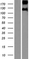 Leptin Receptor (LEPR) Human Over-expression Lysates NM_001003680