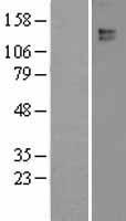 Leptin Receptor (LEPR) Human Over-expression Lysates NM_002303