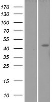 Lunatic Fringe (LFNG) Human Over-expression Lysates NM_001040167