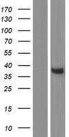 Lunatic Fringe (LFNG) Human Over-expression Lysates NM_001040168