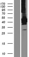 Lunatic Fringe (LFNG) Human Over-expression Lysates NM_001166355