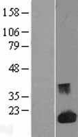 Galectin 1 (LGALS1) Human Over-expression Lysates NM_002305