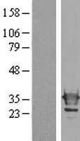 ls003958 galectin 3 lgals3 human over expression lysates nm 002306 wb testing 1