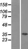 GAL4 (LGALS4) Human Over-expression Lysates NM_006149
