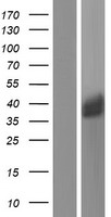 Galectin 8 (LGALS8) Human Over-expression Lysates NM_006499