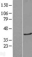 Galectin 8 (LGALS8) Human Over-expression Lysates NM_201543
