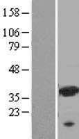 galectin 9 (LGALS9) Human Over-expression Lysates NM_002308