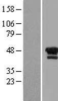 LIM1 (LHX1) Human Over-expression Lysates NM_005568