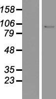 ls003978 dna ligase i lig1 human over expression lysates nm 000234 wb testing 1
