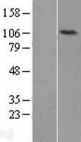 DNA Ligase IV (LIG4) Human Over-expression Lysates NM_002312