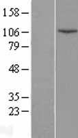 DNA Ligase IV (LIG4) Human Over-expression Lysates NM_206937