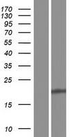 LIM2 Human Over-expression Lysates NM_001161748