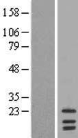 LIM2 Human Over-expression Lysates NM_030657