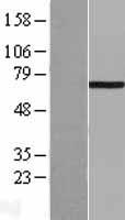 ls003984 lim kinase 1 limk1 human over expression lysates nm 002314 wb testing 1