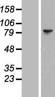 LIM kinase 2 (LIMK2) Human Over-expression Lysates NM_001031801