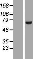 LIM kinase 2 (LIMK2) Human Over-expression Lysates NM_016733