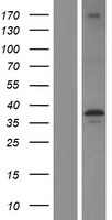 ls003987 lims1 human over expression lysates nm 001193482 wb testing 2