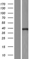 ls003987 lims1 human over expression lysates nm 001193485 wb testing 1