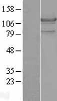 Hormone sensitive lipase (LIPE) Human Over-expression Lysates NM_005357