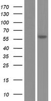 FADS1 Human Over-expression Lysates NM_013402