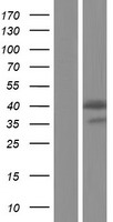 LLGL2 Human Over-expression Lysates NM_001015002