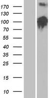 LLGL2 Human Over-expression Lysates NM_001031803