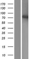 Lamin A (LMNA) Human Over-expression Lysates NM_170708