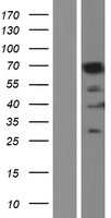 Lamin B1 (LMNB1) Human Over-expression Lysates NM_005573