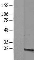 LMO2 Human Over-expression Lysates NM_001142316