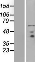 ls004007 prickle3 human over expression lysates nm 006150 wb testing 1
