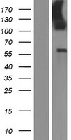 LMO7 Human Over-expression Lysates NM_005358