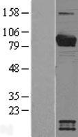 Breast cancer suppressor candidate 1 (VWA5A) Human Over-expression Lysates NM_014622