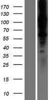 LOXL1 Human Over-expression Lysates NM_005576