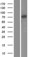 Lactoperoxidase (LPO) Human Over-expression Lysates NM_001160102