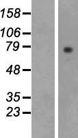 Lactoperoxidase (LPO) Human Over-expression Lysates NM_006151