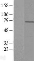 LRCH4 Human Over-expression Lysates NM_002319