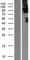 LRP3 Human Over-expression Lysates NM_002333
