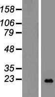 LTA Human Over-expression Lysates NM_001159740