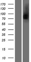 Lactoferrin (LTF) Human Over-expression Lysates NM_002343