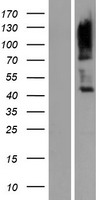 CD229 (LY9) Human Over-expression Lysates NM_002348
