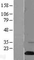 SH2D1A Human Over-expression Lysates NM_002351