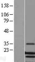 Lysozyme (LYZ) Human Over-expression Lysates NM_000239