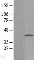 MAB21L1 Human Over-expression Lysates NM_005584