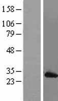 MAD2 (MAD2L1) Human Over-expression Lysates NM_002358