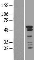 SMAD1 Human Over-expression Lysates NM_001003688